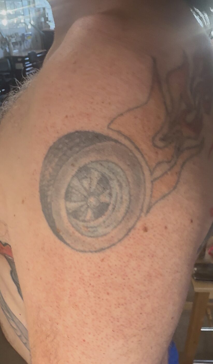 Old faded wheel tattoo on the shoulder before a cover-up